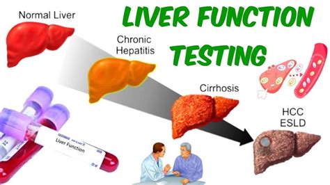 drugs hard on liver blood tests|medications that increase liver function.